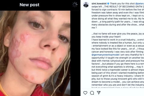GNTM-Siegerin Simone "Simi" Kowalski erhebt Vorwürfe gegen Modelbranche