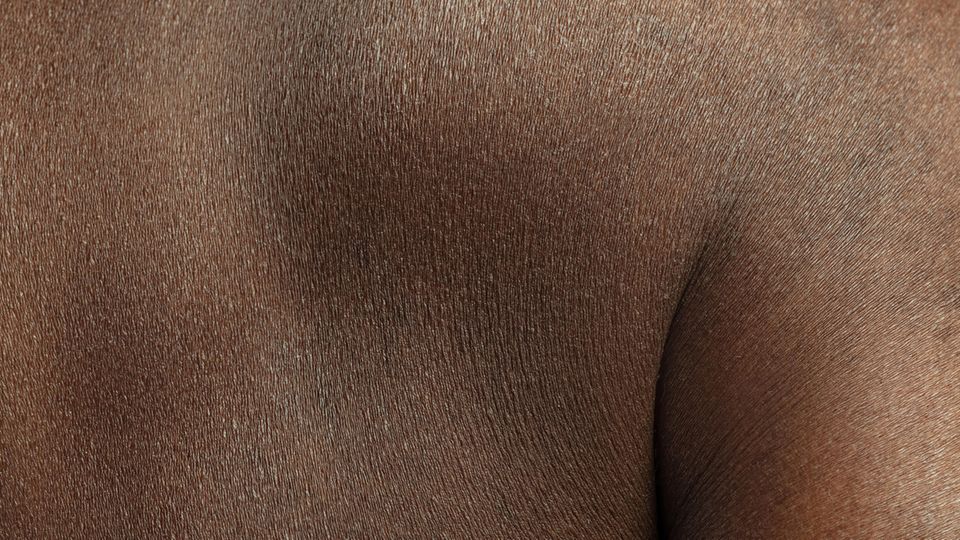 Besonders in der Dermatologie ist Inklusion sehr wichtig. Hautkrankheiten werden in Lehrbüchern kaum auf schwarzer Haut gezeigt.