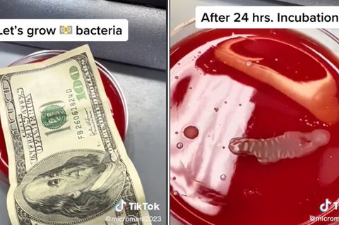 So schmutzig ist Geld – Wissenschaftlerin untersucht Scheine und macht ekelige Entdeckung