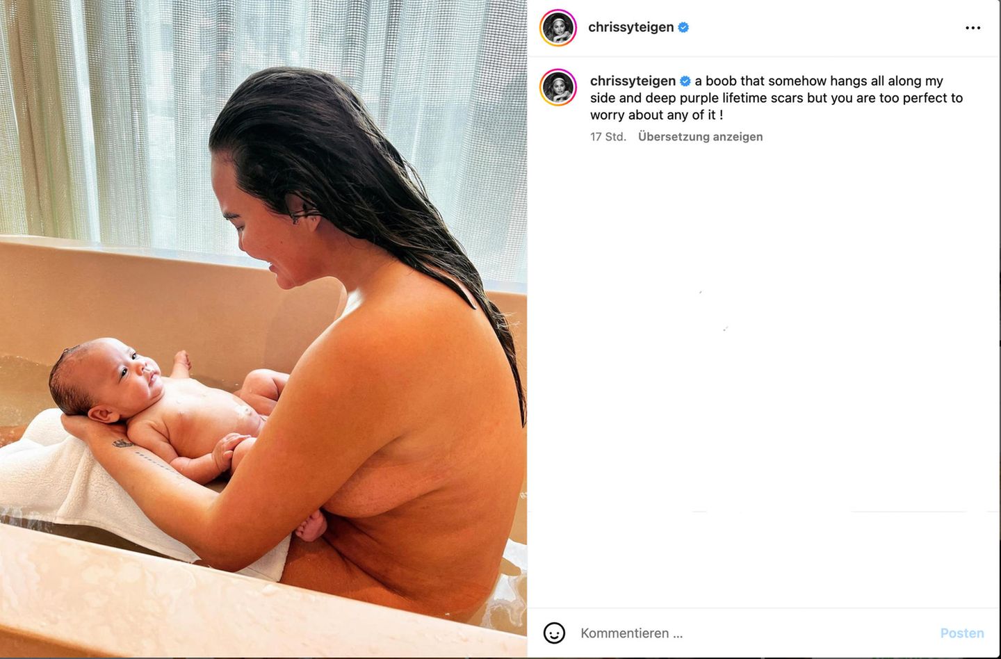 Chrissy Teigen zeigt sich mit Dehnungssstreifen und Baby in der Wanne |  STERN.de