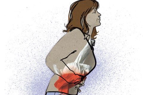 Illustration Darmendometriose