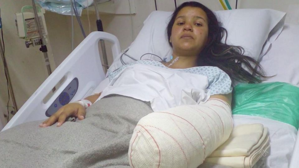 Gleice kam zur Entbindung und verlor ihre Hand – zahlreiche Frauen verklagen Privat-Klinik in Rio Gleice kam zur Entbindung und verlor ihre Hand – zahlreiche Frauen verklagen Privat-Klinik in Rio
