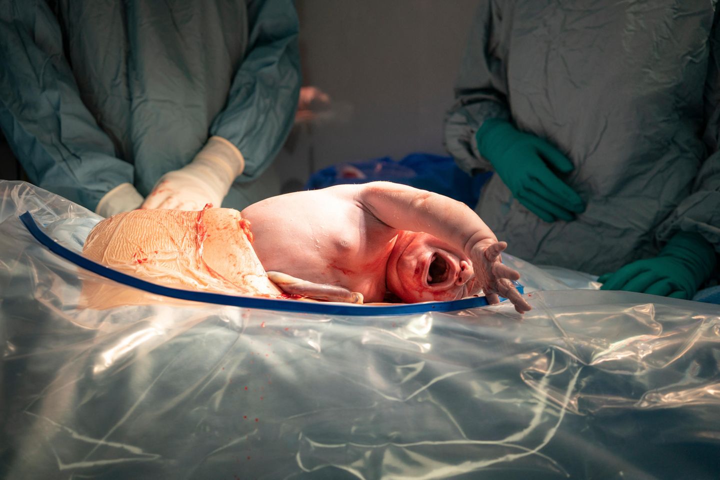 Neugeborenes in der Plazenta