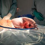 Neugeborenes in der Plazenta