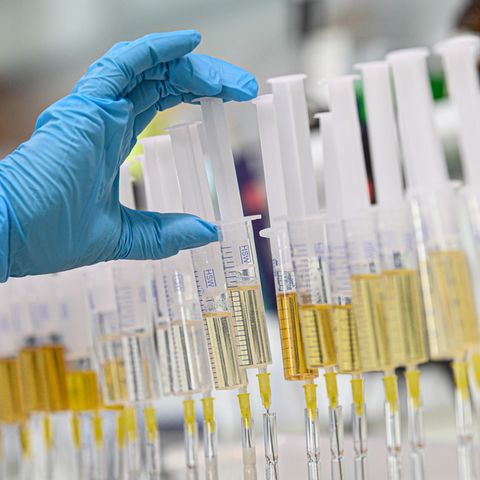 Doping: Wada überfährt mehr als 200 Sportler aus Russland  Spritzen mit Urin stehen für die erweiterte Doping-Kontrolle nach Auffälligkeiten im Steroidprofil (Symbolbild)