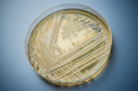 Candida auris