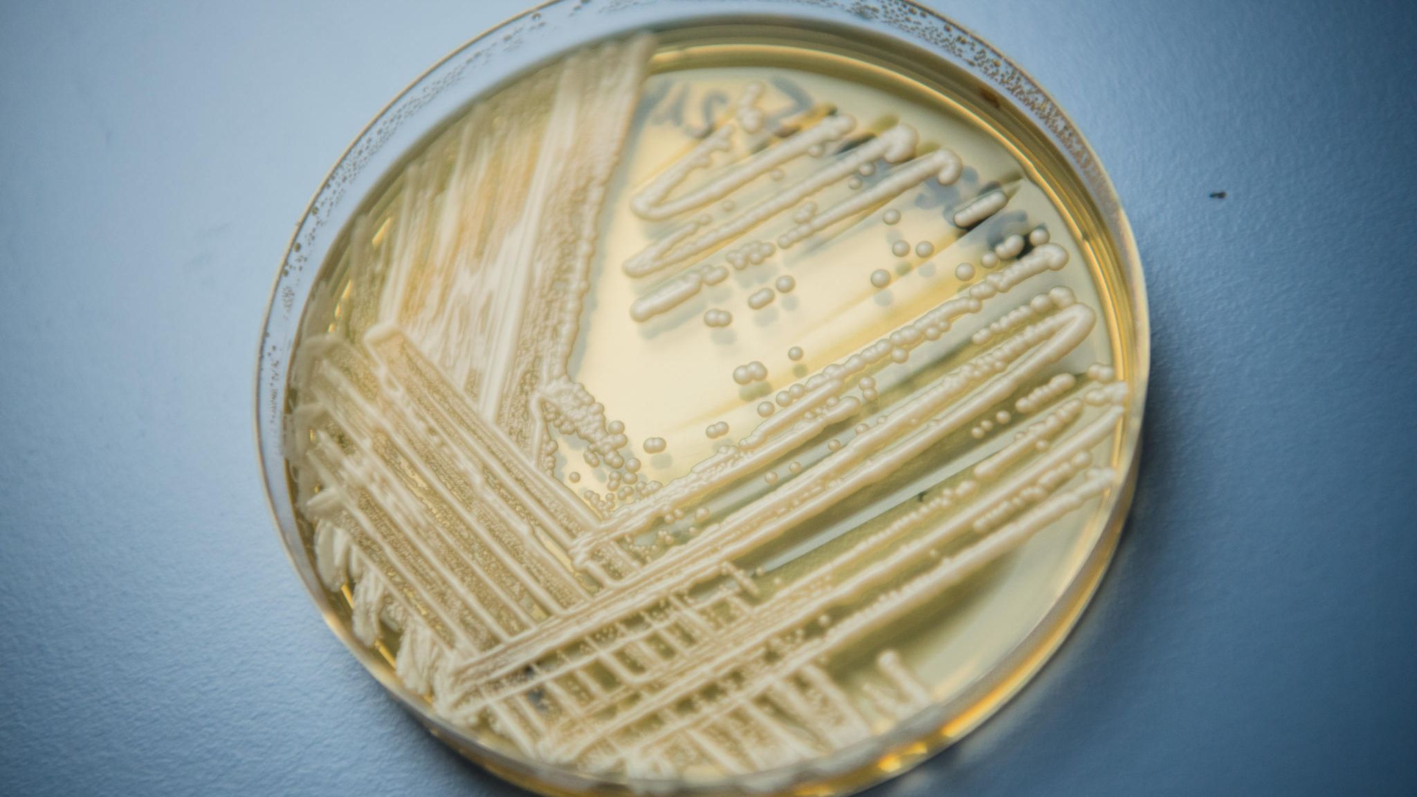 Candida auris: Gefährlicher Hefepilz breitet sich aus – was man wissen muss  | STERN.de