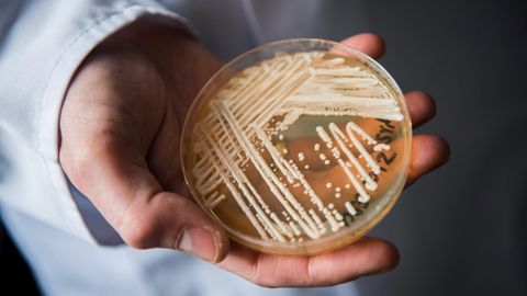 Candida auris in einer Petrischale