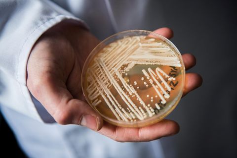 Candida auris in einer Petrischale