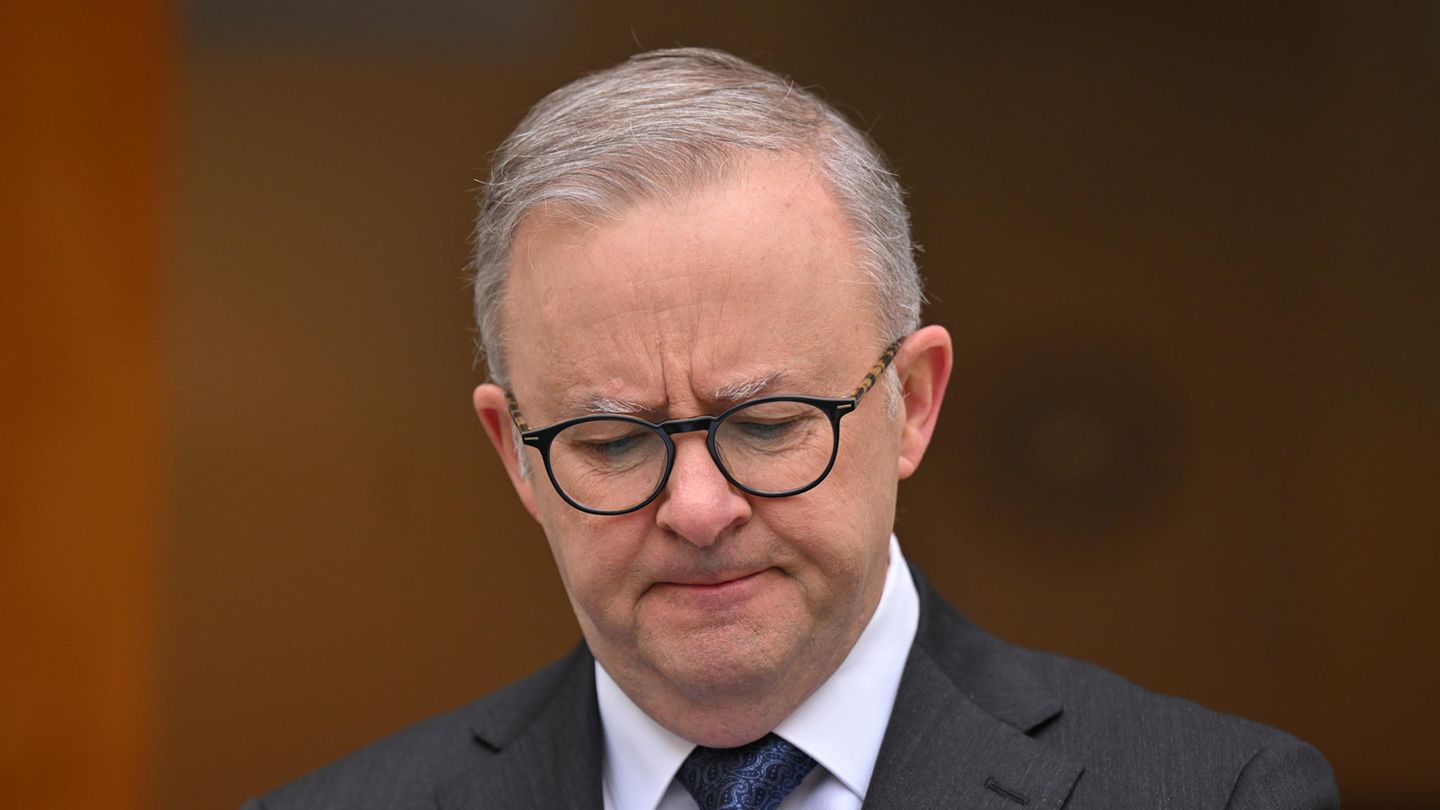 Anthony Albanese, Premierminister von Australien, schaut verkniffen nach unten.