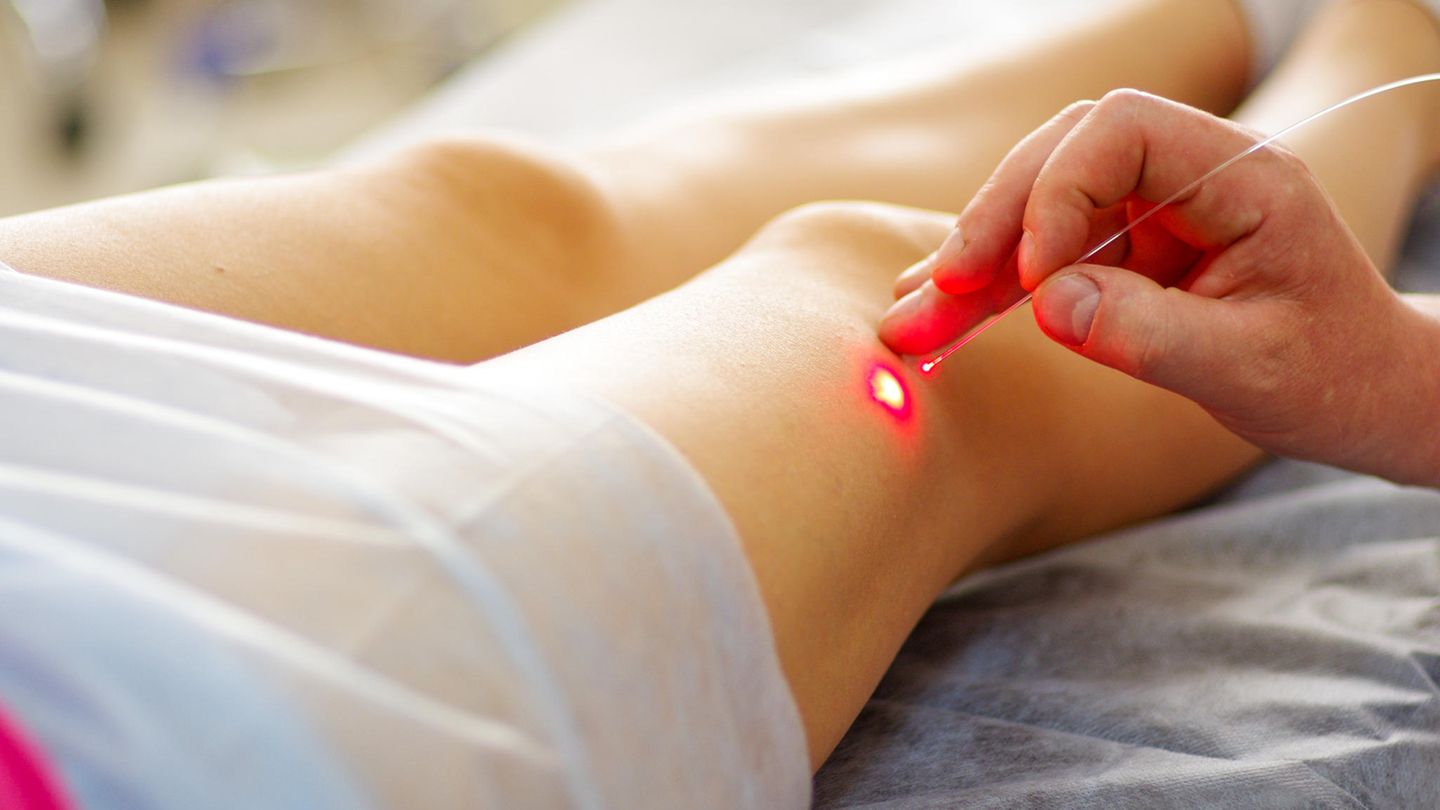 Gefäßmedizin: Das sind die ausgezeichneten Kliniken