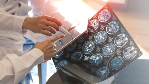 Multiple Sklerose: Das sind die ausgezeichneten Kliniken