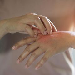 Hautkliniken: Das sind die ausgezeichneten Kliniken