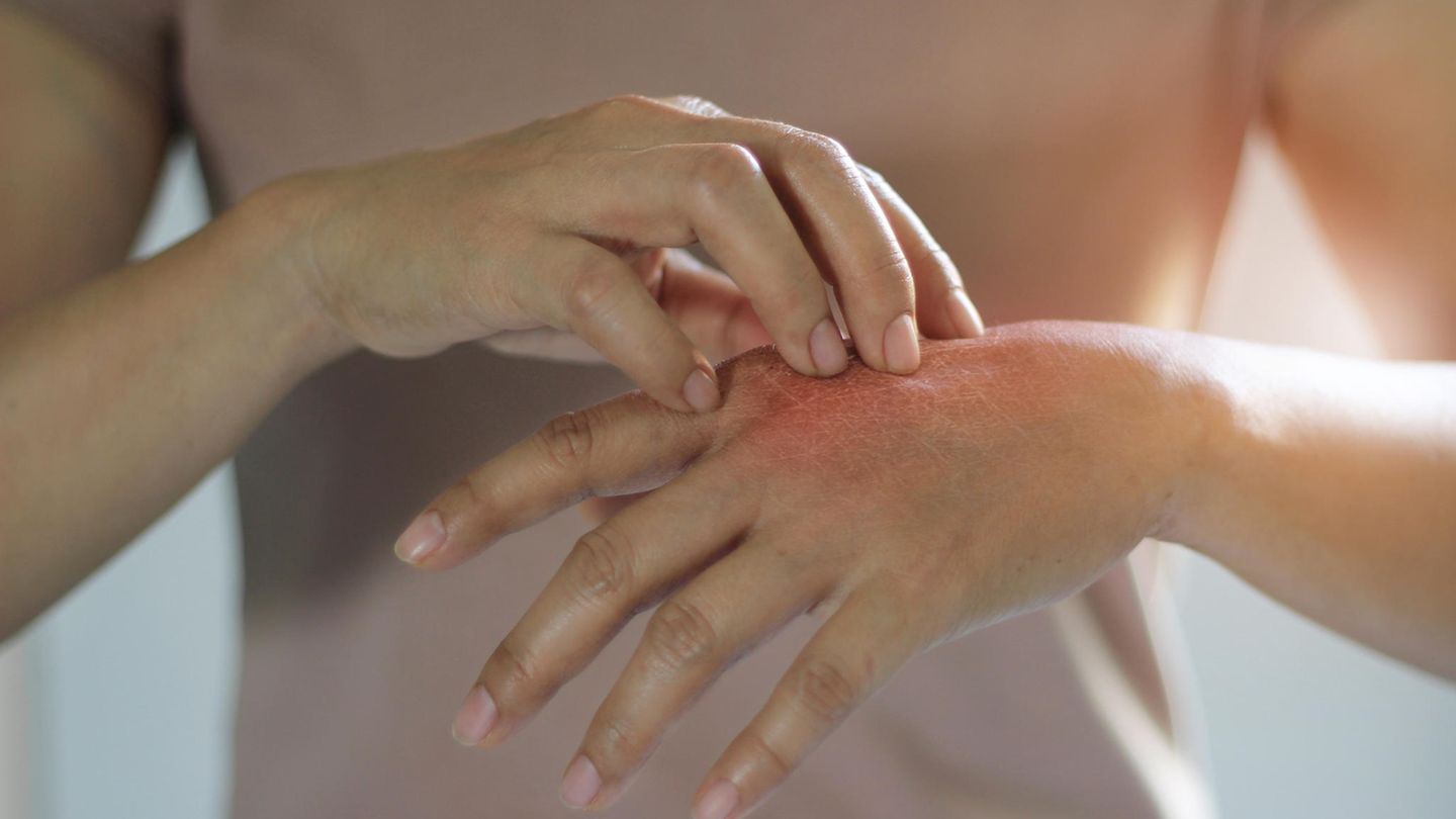 Hautkliniken: Das sind die ausgezeichneten Kliniken