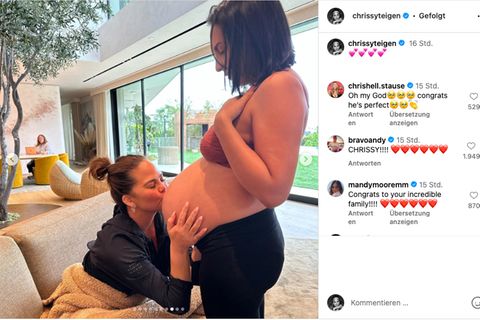 Chrissy Teigen