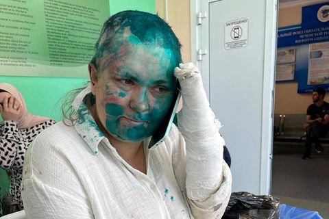 Elena Milaschina in einem Krankenhaus in Grosny