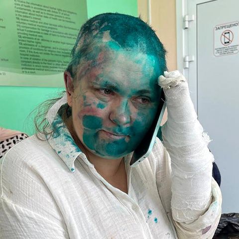 Elena Milaschina in einem Krankenhaus in Grosny