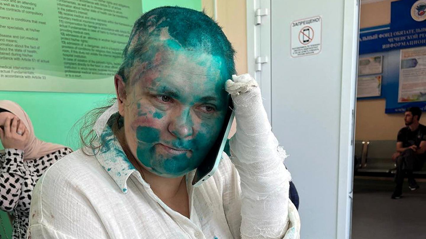 Elena Milaschina in einem Krankenhaus in Grosny