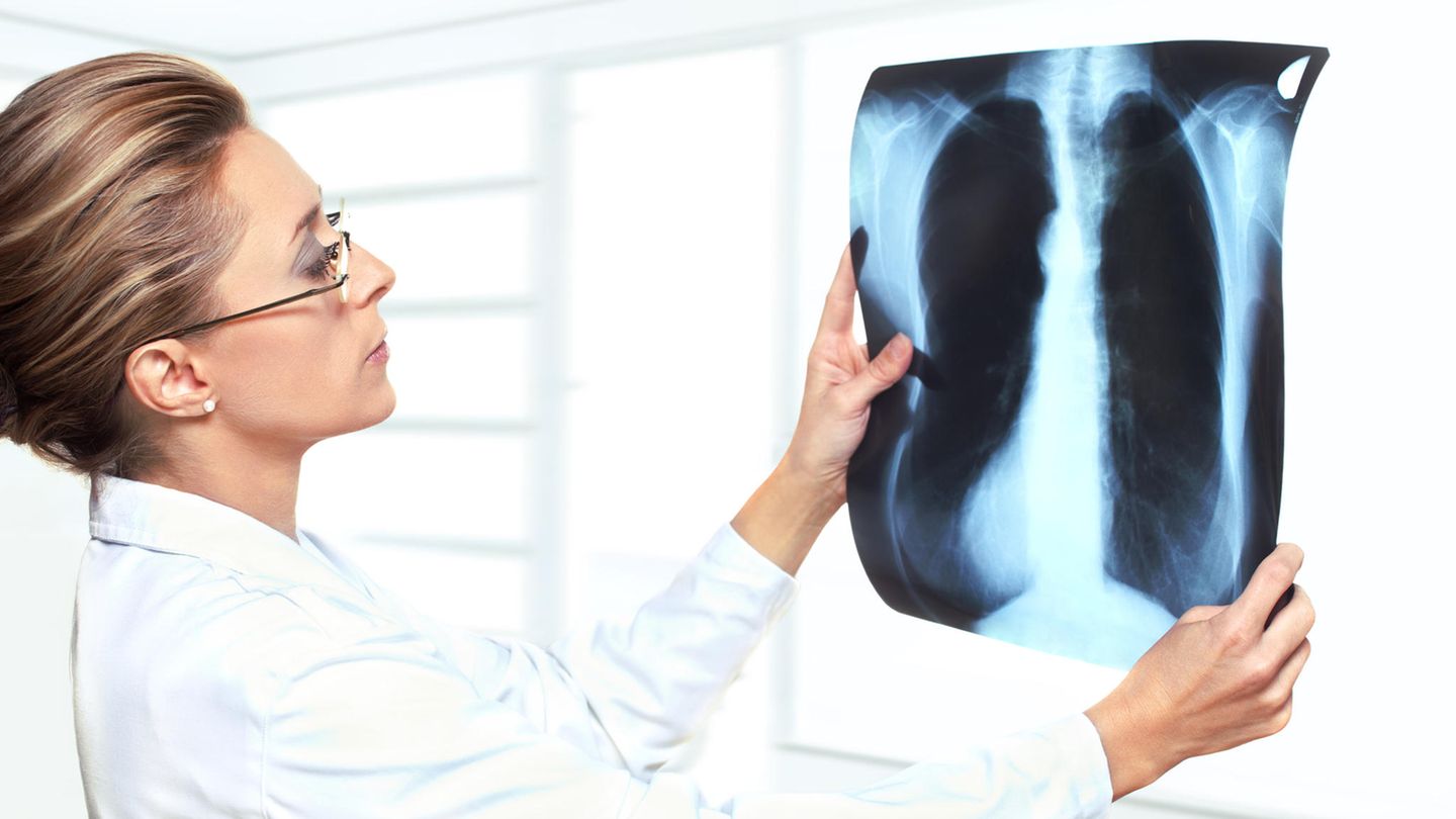 Pneumologie: Das sind ausgezeichnete regionale Kliniken