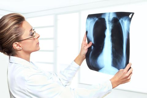 Pneumologie: Das sind ausgezeichnete regionale Kliniken