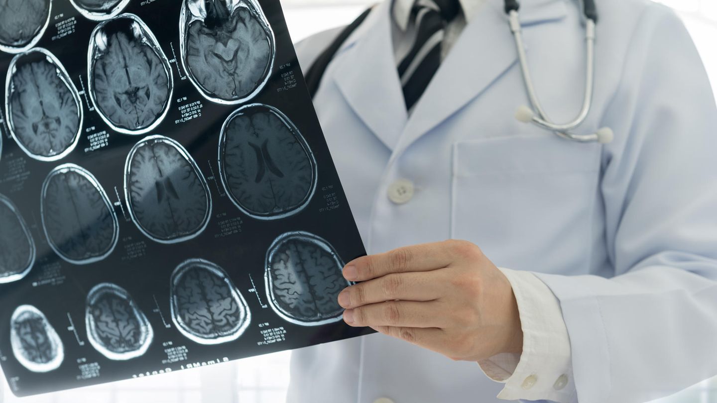 Schlaganfall: Das sind ausgezeichnete regionale Kliniken