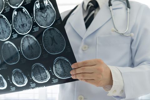 Schlaganfall: Das sind ausgezeichnete regionale Kliniken