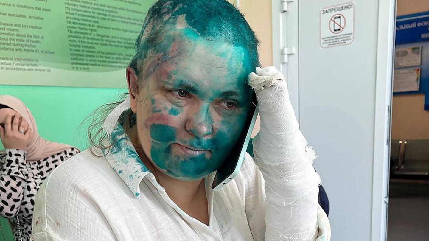 Jelena Milaschina nach dem Angriff: Sie wurde mit Farbe übergossen, ihre gebrochenen Finger sind eingegipst Jelena Milaschina nach dem Angriff: Sie wurde mit Farbe übergossen, ihre gebrochenen Finger sind eingegipst