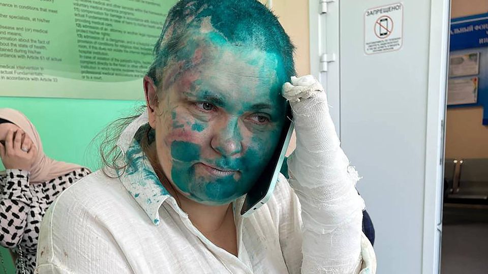 Jelena Milaschina nach dem Angriff: Sie wurde mit Farbe übergossen, ihre gebrochenen Finger sind eingegipst