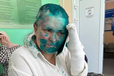 Jelena Milaschina nach dem Angriff: Sie wurde mit Farbe übergossen, ihre gebrochenen Finger sind eingegipst