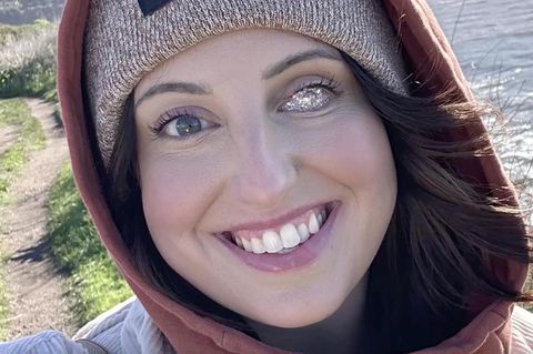 Rachel war gerade einmal 18 Monate alt, als bei ihr ein Krebsgeschwür im Auge diagnostiziert wurde. Seitdem trägt sie eine Augenprothese– aber nicht irgendeine, denn die 32-jährige US-Amerikanerin setzt auf eine Glitzer-Optik. 