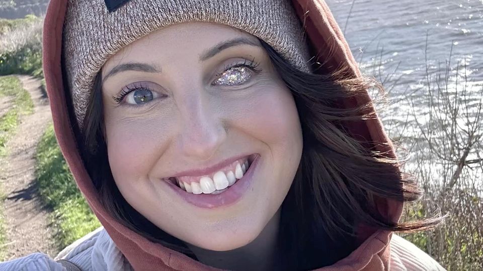 Fun Eye: Augenprothese der besonderen Art Rachel war gerade einmal 18 Monate alt, als bei ihr ein Krebsgeschwür im Auge diagnostiziert wurde. Seitdem trägt sie eine Augenprothese– aber nicht irgendeine, denn die 32-jährige US-Amerikanerin setzt auf eine Glitzer-Optik.