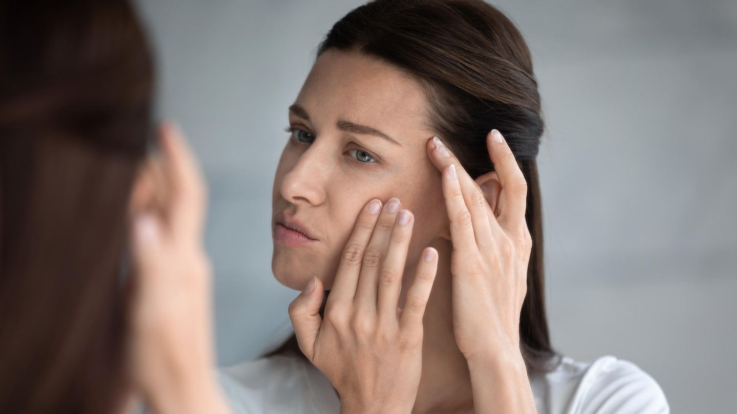 Remove pimples: The best tips for even skin