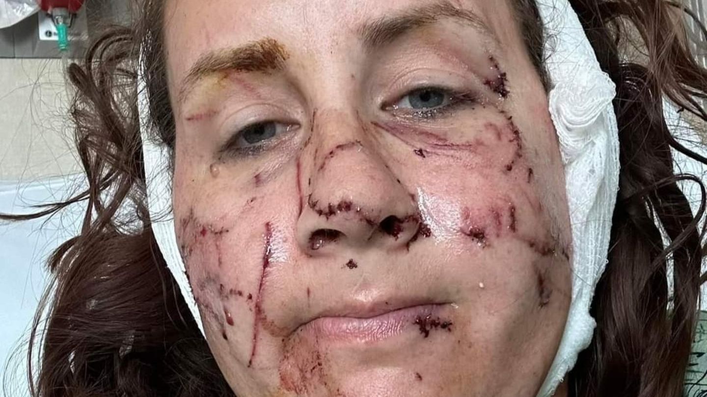 USA: "Ich war blut&uuml;berstr&ouml;mt": Frau wird bei Fluss-Tour von Otter angegriffen und schwer verletzt