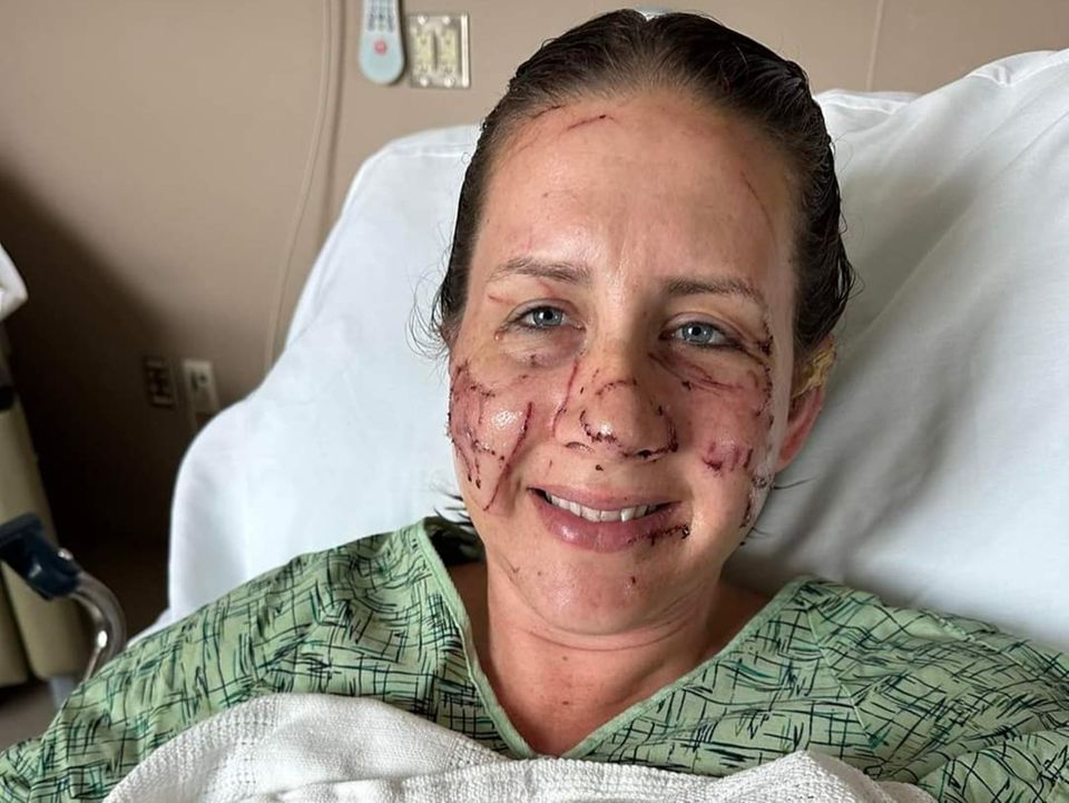Otter Jen Royce USA Mittlerweile kann Jen Royce wieder lachen, doch bis sie den Otter-Angriff verarbeitet hat, wird wohl noch eine Weile vergehen