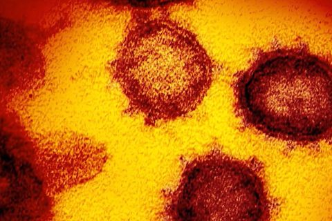 Neue Variante "Eris": Was Sie jetzt über das Coronavirus wissen müssen