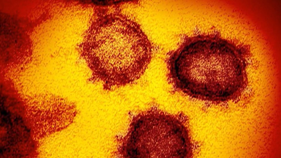 Neue Variante "Eris": Was Sie jetzt über das Coronavirus wissen müssen