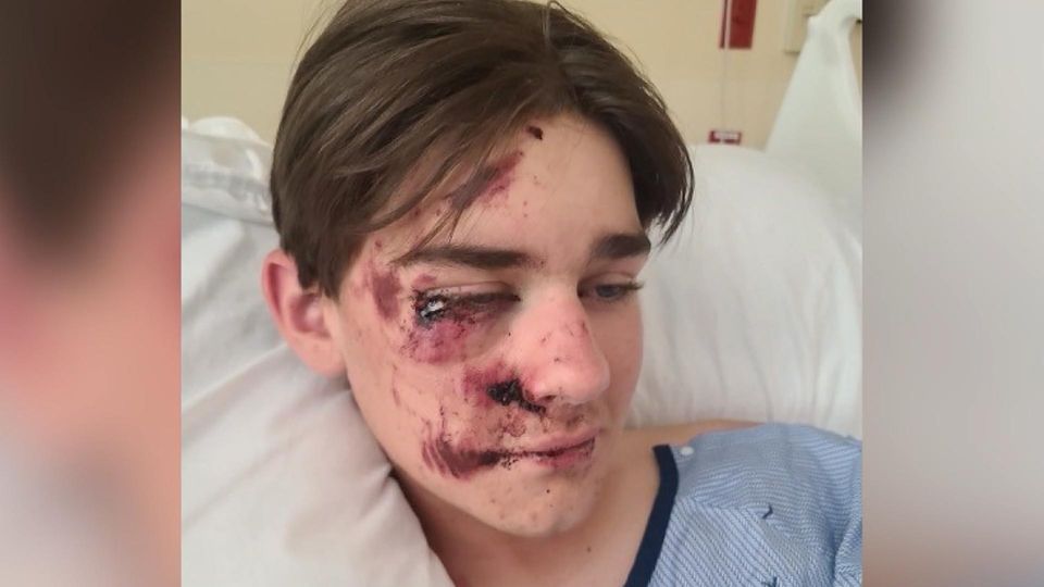 "Fast gestorben": Teenie meldet sich nach Klippensturz am Grand Canyon