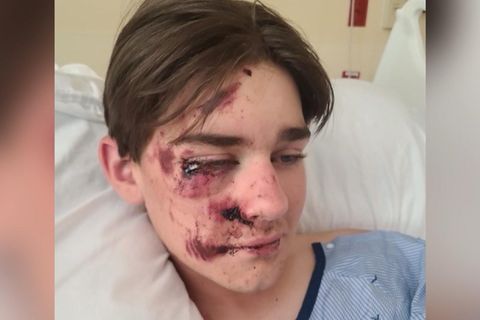 "Fast gestorben": Teenie meldet sich nach Klippensturz am Grand Canyon