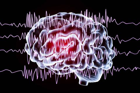 Computerillustration eines Gehirns und Gehirnwellen bei Epilepsie