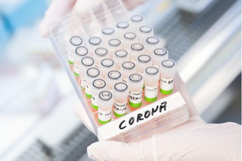Coronatest Labor