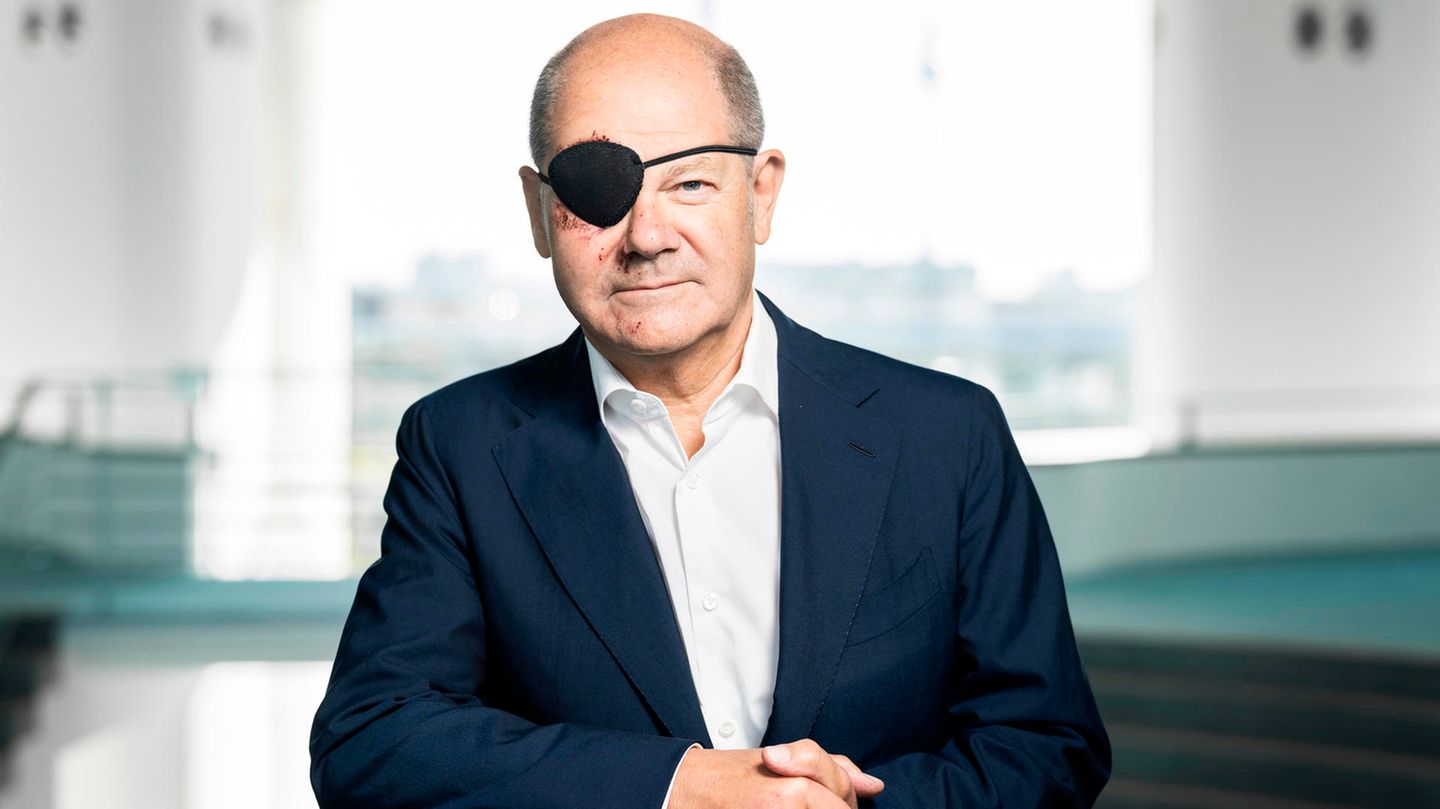 Olaf Scholz wears an eye patch after a fall: “I look forward to the memes”