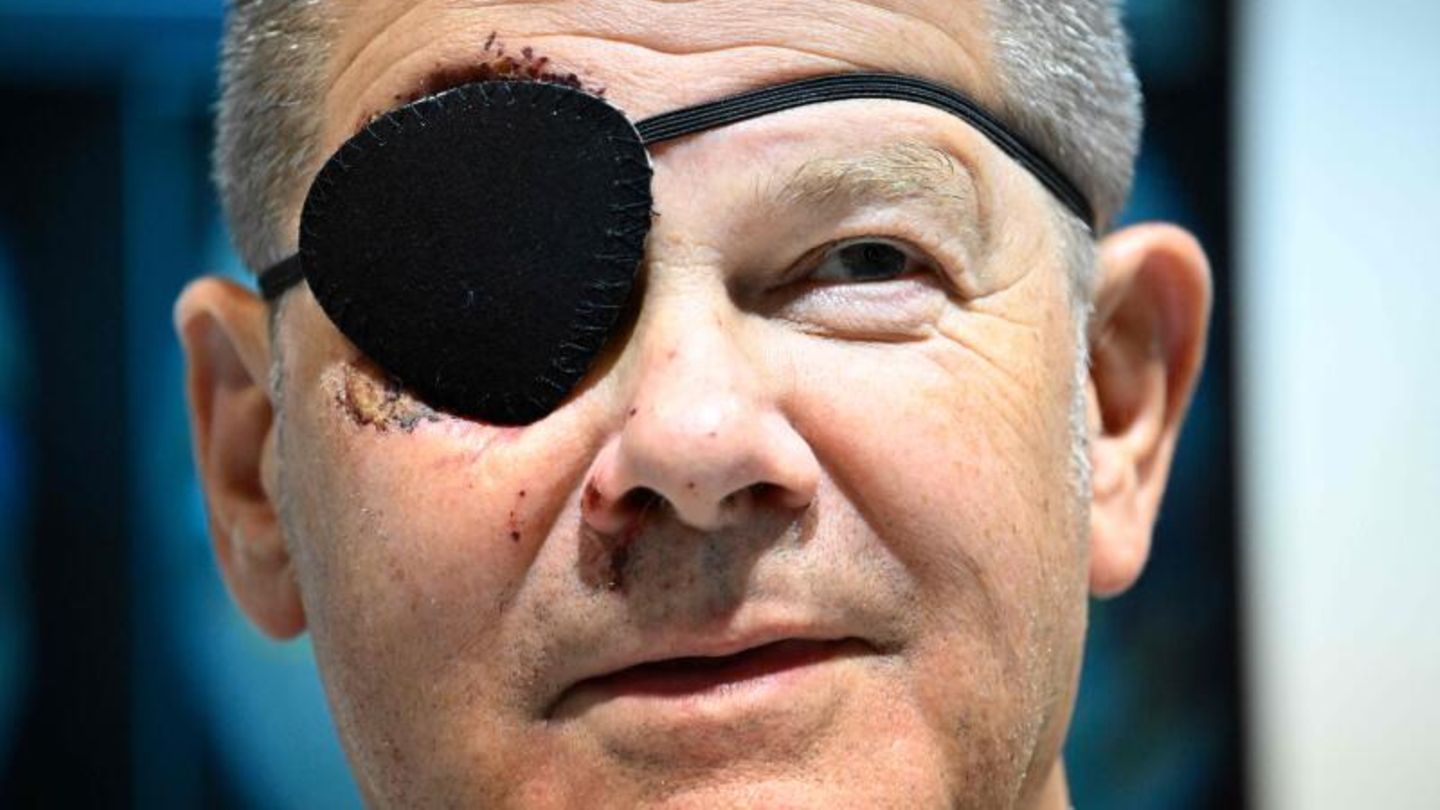 Seine auffällige Augenklappe nimmt der Kanzler mit Humor. "Das Wochenende hat mir auch ganz persönlich gezeigt: So schön Joggen ist, für manche Strecken nimmt man doch besser das Auto", scherzt Scholz, der beim Joggen gestürzt war