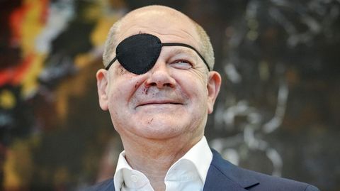 Nach einem Sportunfall trägt Bundeskanzler Olaf Scholz (SPD) eine Augenklappe