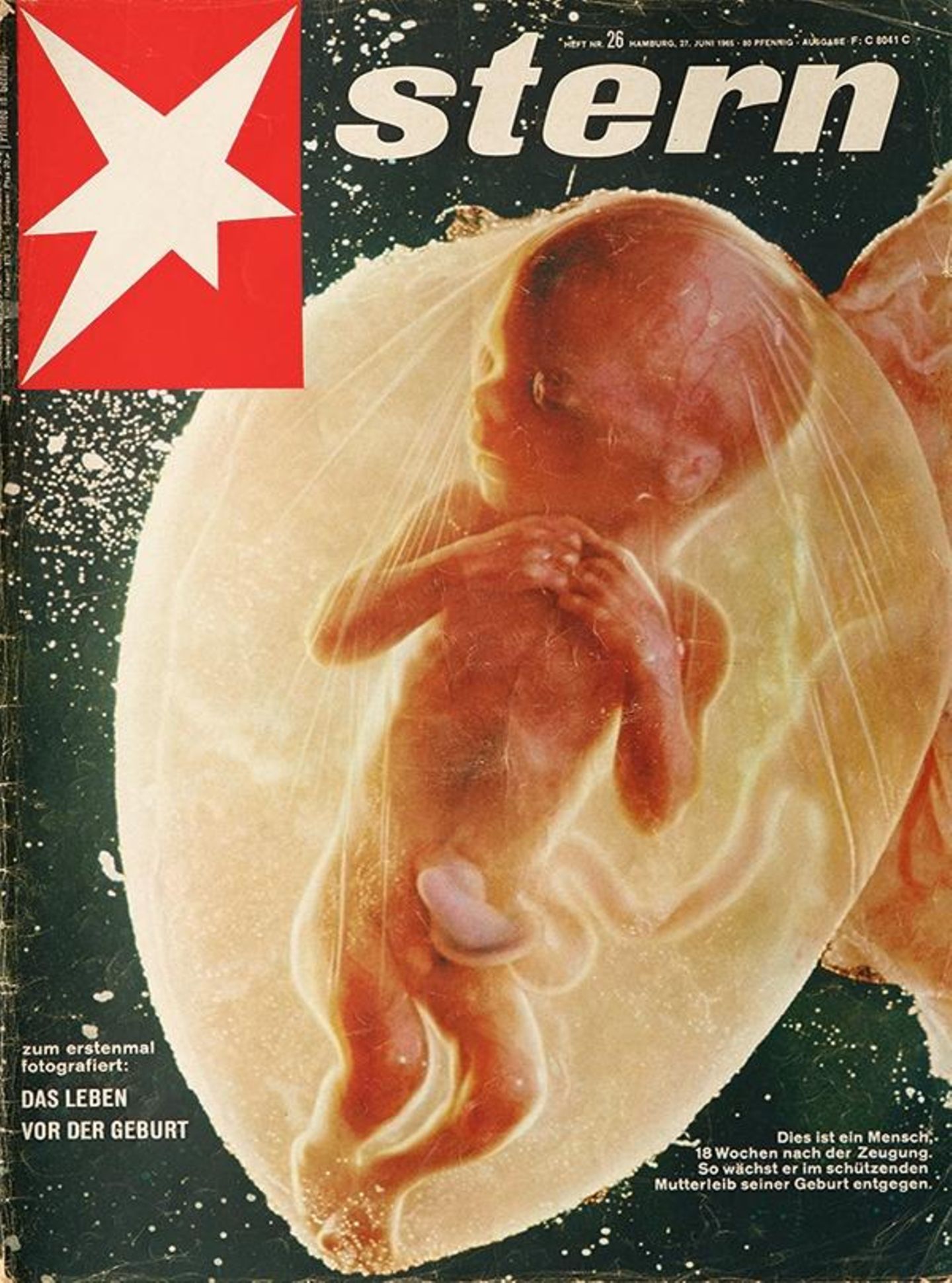 Stern-Cover Embryo