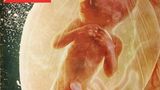 Stern-Cover Embryo