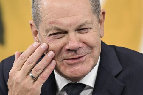 Olaf Scholz betastet mit rechts sein rechtes Auge, an dem noch Schrammen eines Sturzes zu erkennen sind