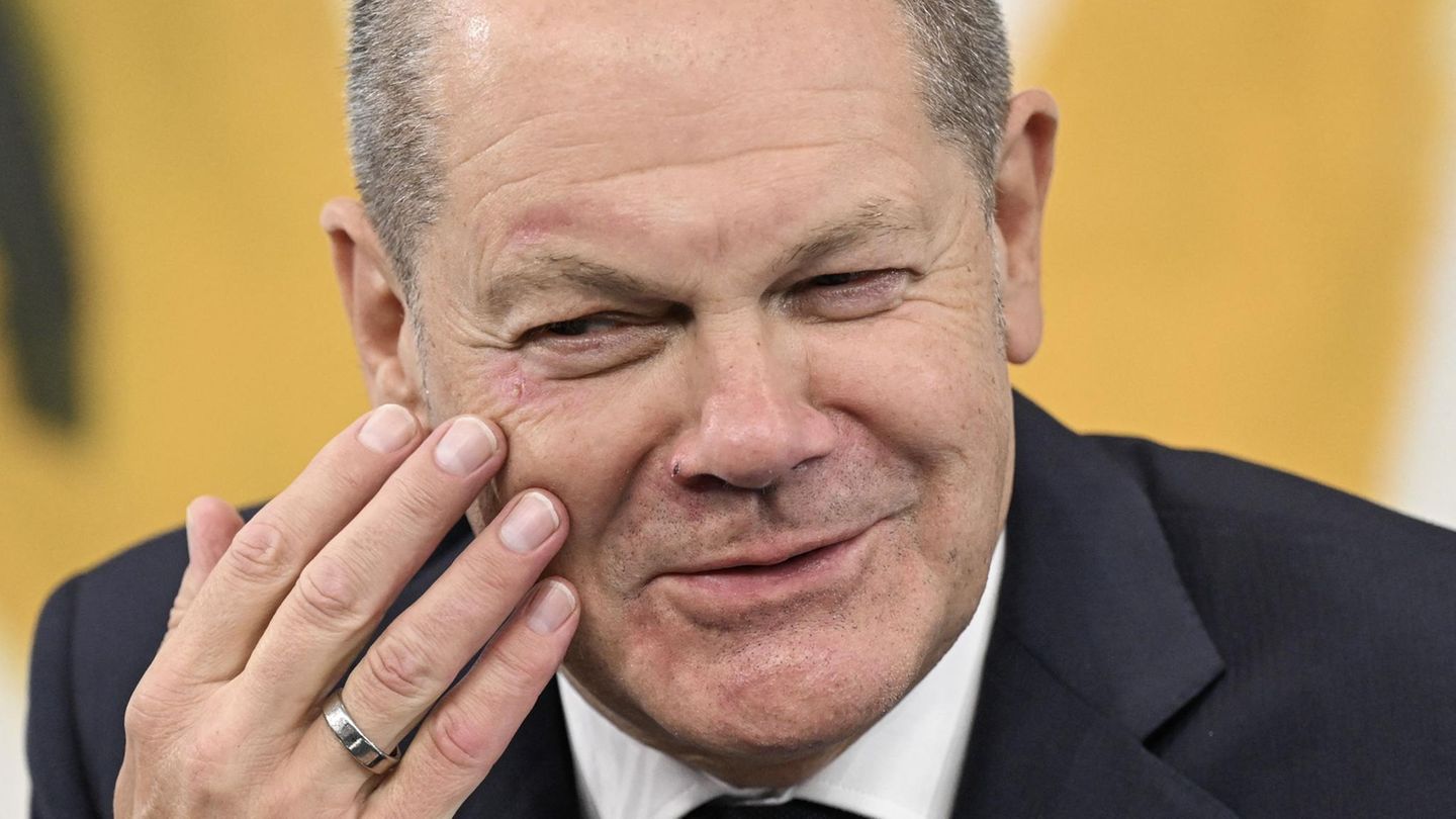 Olaf Scholz betastet mit rechts sein rechtes Auge, an dem noch Schrammen eines Sturzes zu erkennen sind