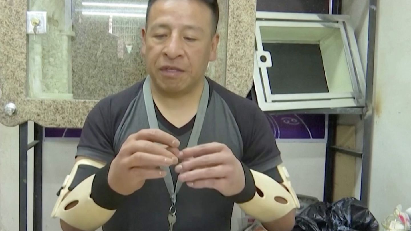 Bolivien: Opfer von Dynamitexplosion bekommt täuschend echte Hand-Prothese (Video)