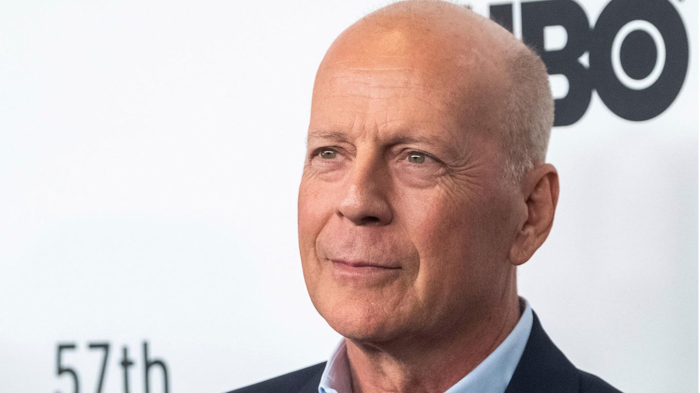 The Bruce Willis case: Alzheimer’s is just one form of dementia – an overview