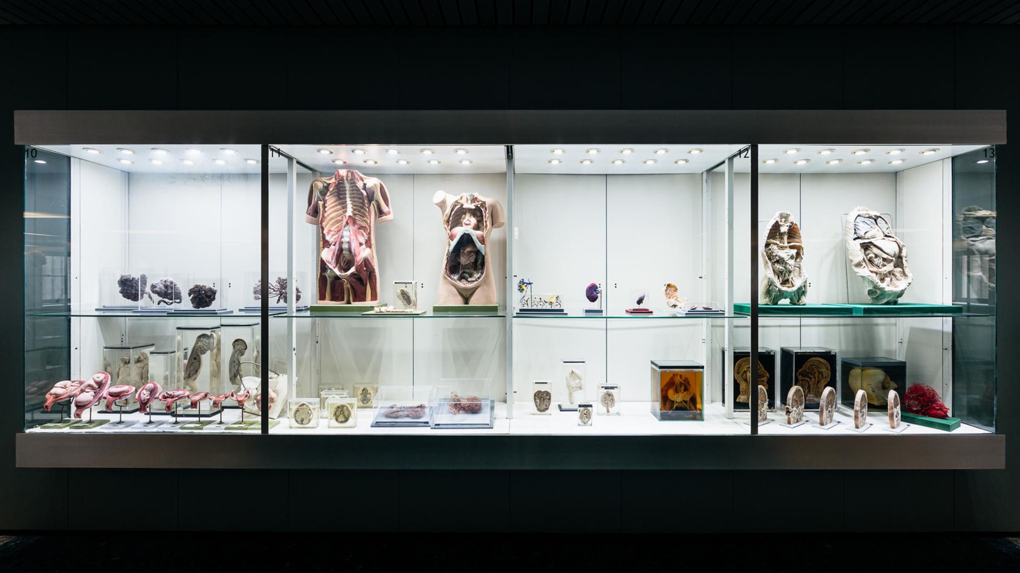 Anatomie: Vitrine mit menschlichen Modellen und Präparaten
